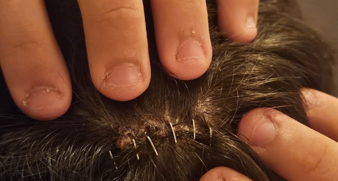 נער מהרצליה הותקף באכזריות: “הילד כמעט לא חזר הביתה חי”